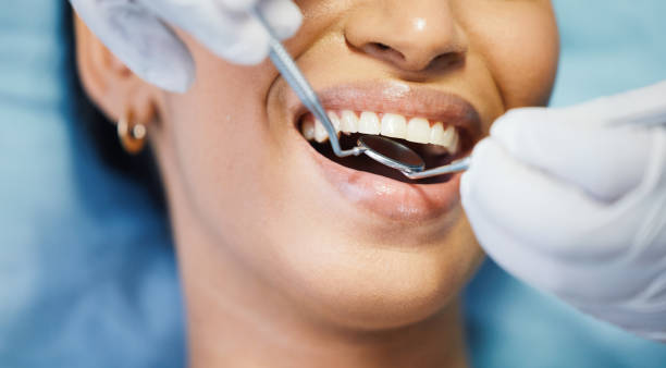 Best Emergency Dentist for Knocked-Out Tooth in Oxford, AL