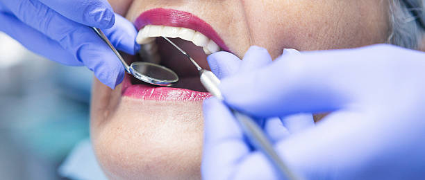 Best Emergency Dental Extractions in Oxford, AL